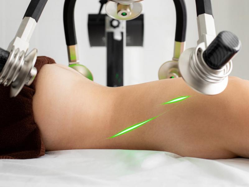 5 Vantagens do Aluguel Luz Pulsada para Clínicas