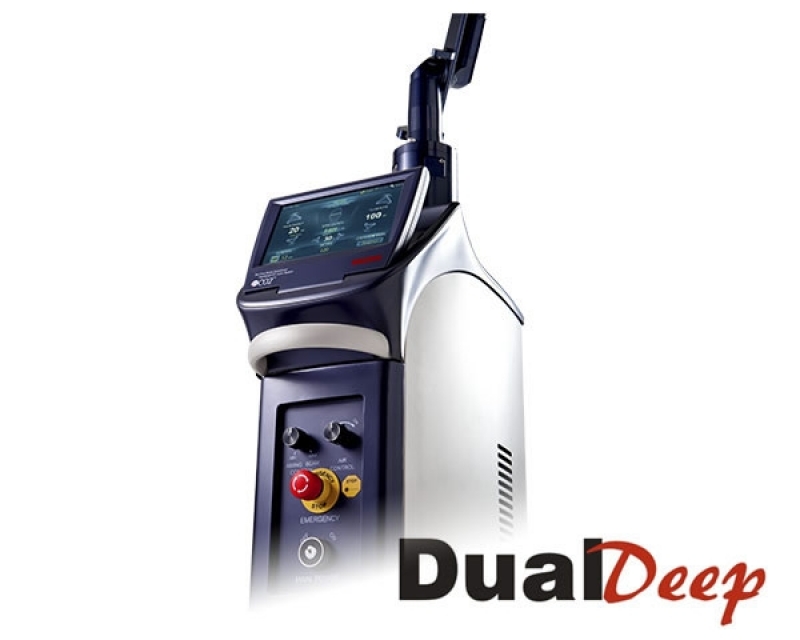 Aluguel de Dual Deep para Cicatrizes Preços Santos - Locação de Laser Co2 Dual Deep